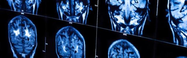 How your brain may drive bitcoin higher