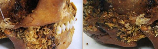 Iron Age Surgeons Fixed a Woman’s Shattered Jaw With Primitive Prosthetic—and She Survived