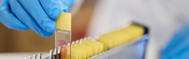 Dublin’s Deciphex draws €15M to defeat dangerous diagnostic delays 