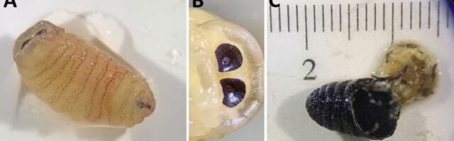 The ‘Biologically Implausible’ Case of the Woman Who Sneezed Maggots