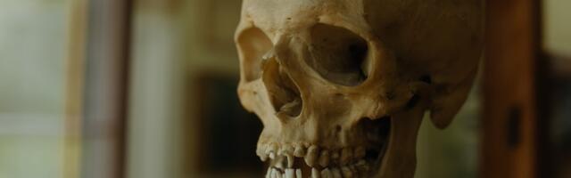 Scientists Find the Grossest, Most Efficient Way to Clean a Skeleton