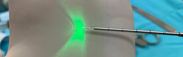 Долой геморрой, или как от него избавиться за 1 день?