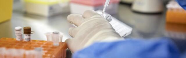 Supercharging Immune Cells May Help Control HIV Long-Term
