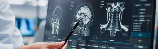 Scientists to use AI and 1.6 million brain scans for earlier and more accurate dementia diagnoses