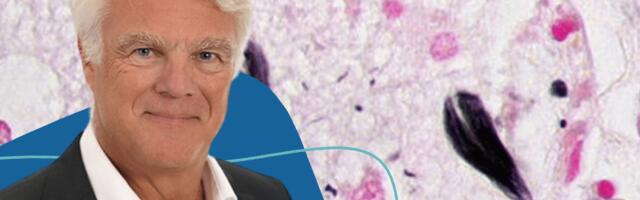 German BioTech Exciva lands €51 million to advance Alzheimer’s drug testing in patients