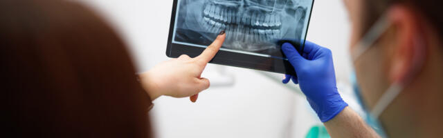 Routine dental X-rays are not backed by evidence—experts want it to stop