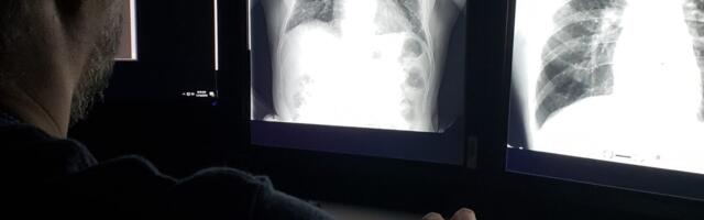 Lung Power Peaks in Our 20s—and It’s a Steady Decline From There, Study Finds