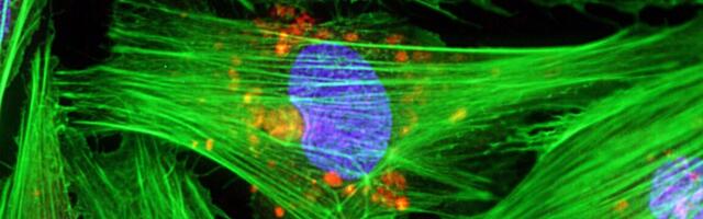 Stem cells used to partially repair damaged hearts