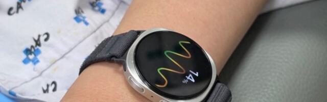 Sorry, Apple: Samsung’s Fainting Detection Is a Game Changer