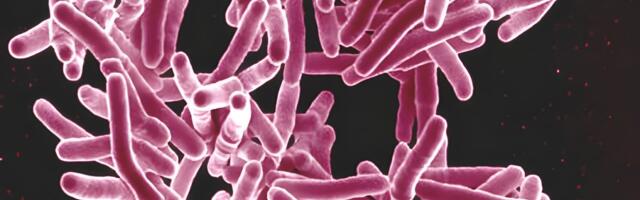 Why you don’t want to get tuberculosis on your penis