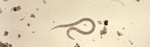 Doctors find worms squirming through teen’s neck: A cautionary tale