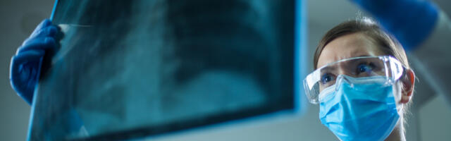 Optellum raises £13m to spot early signs of lung cancer with AI