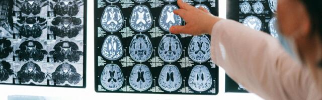 Can Theoretical Neuroimaging Solve Problematic Internet Use?