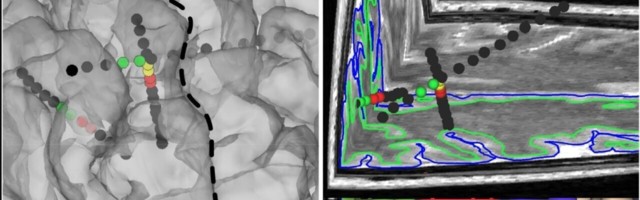 Eureka! Brain implant creates feelings in the fingertips