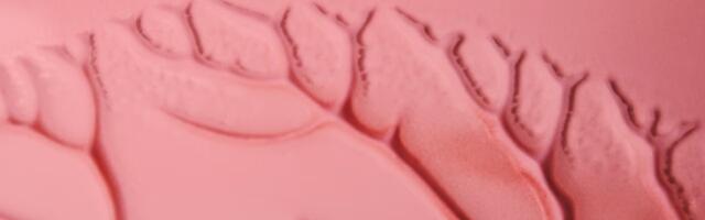 Swedish biotech VERIGRAFT secures €1.2M from Eurostars to advance 3D-printed arterial grafts