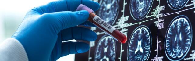 Blood Tests for Alzheimer’s Are Here