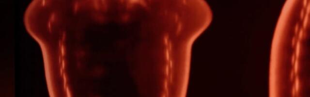 Remember Midjourney? It’s Building a Medical Scanning Device That It Says Is Cheaper Than an MRI
