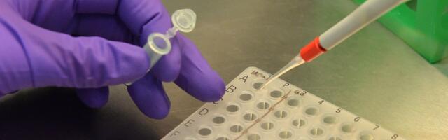 Why we’re scared of AI and not scared enough of bio risks