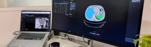 French startup Raidium secures 13M Seed for precision radiology