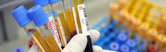 Simple Blood Test Can Predict Dementia 25 Years in Advance, Study Suggests