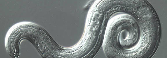 Burning in woman’s legs turned out to be slug parasites digging in her brain
