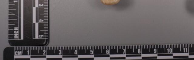 Protein in Homo erectus teeth suggests Denisovans gave us some of their DNA