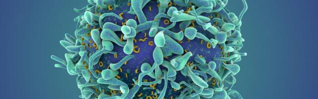 A revolutionary cancer treatment could transform autoimmune disease