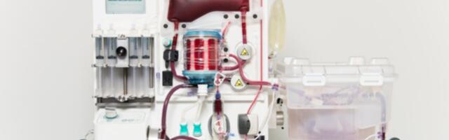 Oxford’s OrganOx raises a £25 million profusion to expand its commercial footprint and make transplant organs more widely available