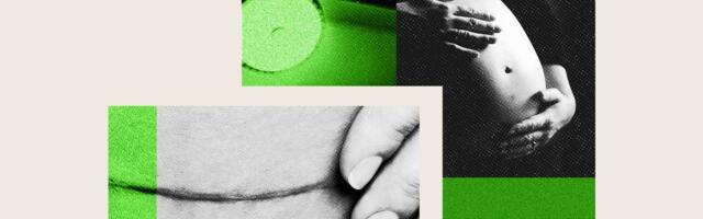 How Business Insider investigated C-sections at over 1,700 American hospitals