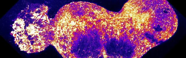 Scientists recreate brain circuit in lab for first time