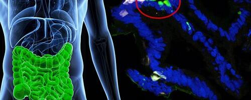 Scientists reverse diabetes in mice by hacking human cells to make insulin