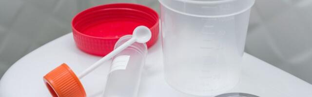 Same Poop, Different Results: At-Home Gut Health Tests Are Wildly Inconsistent, Study Finds