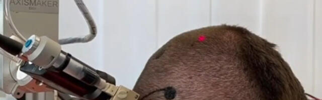What Is An Electric Tattoo & How Does It Work?