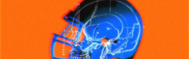 Why it’s so hard to make a ‘safer’ football helmet