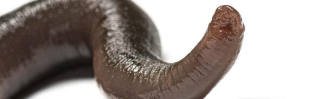 Man accidentally gets leech up his nose. It took 20 days to figure it out. Man accidentally gets leech up his nose. It took 20 days to figure it out.