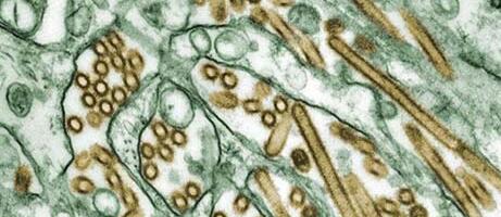 As US marks first H5N1 bird flu death, WHO and CDC say risk remains low