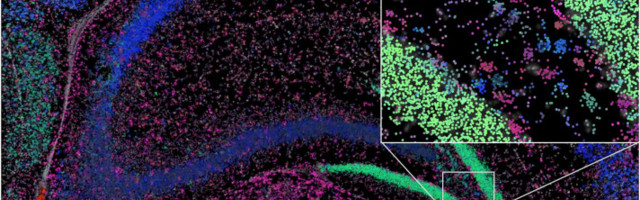 Deep Science: Alzheimer’s screening, forest-mapping drones, machine learning in space, more