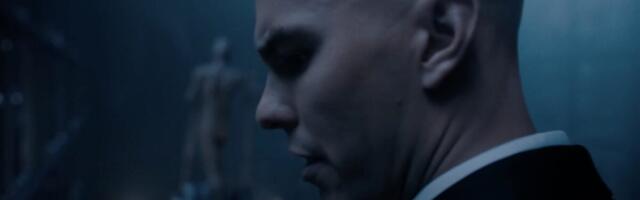 What’s the Deal With That Freaky Bald Creature in ‘Superman’?