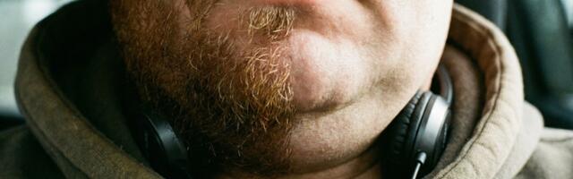 Второй подбородок — это не жир, а вода из-за смартфонной или ноутбучной шеи