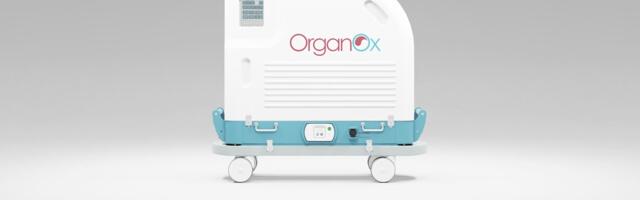 OrganOx £25m raise a ‘step in direction’ of future IPO