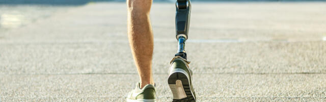 Birmingham’s Adapttech raises £2.25m for prosthetic technology