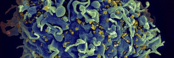 California lab makes new discovery in search for HIV vaccine