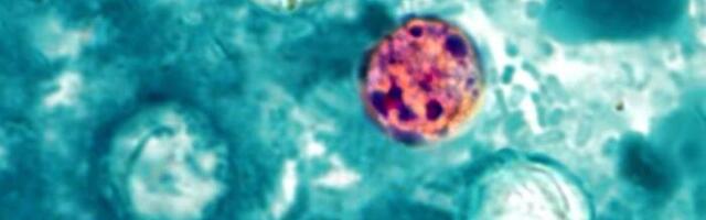 FDA reports new outbreak of explosive diarrhea with 72 cases identified