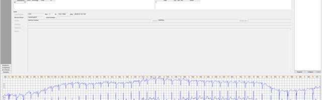 Реверс инжиниринг чистой архитектуры