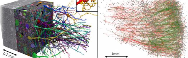 Низкая эффективность нейрональных сетей мозга как возможная причина возникновения болезни Альцгеймера