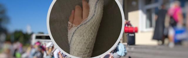 Первоклассница столичной школы получила тяжелую травму и лишилась части пальца. Полиция проверила инцидент