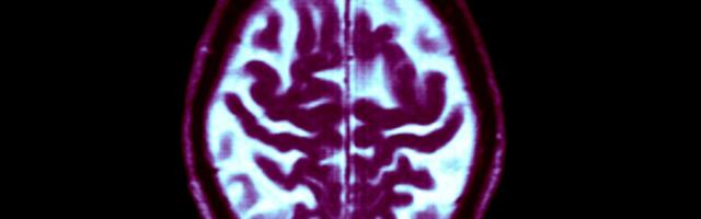 We’re not as helpless against dementia as we think