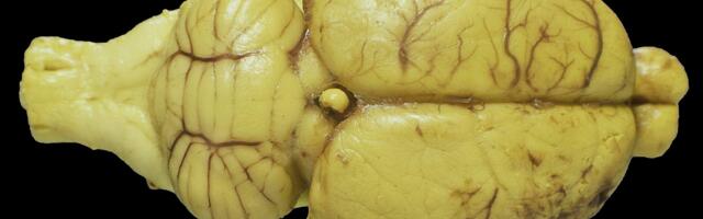 Researchers train living rat neurons to perform real-time AI computations — experiments could pave the way for new brain-machine interfaces