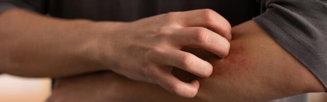 Should You Scratch That Itch? Science Has a Surprising Answer