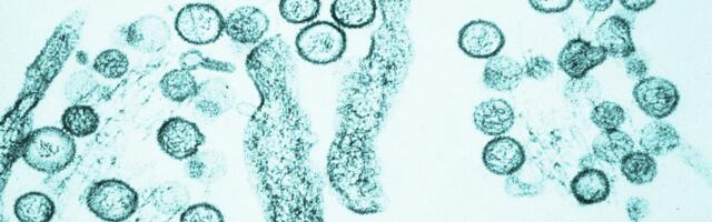 Colorado Reports Its First Hantavirus Death Since 2024